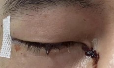 九游娱乐vip注册-球员意外受伤，比赛现场陷入紧张